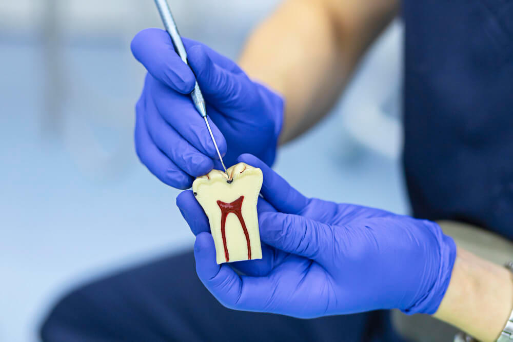 Especialista en endodoncia en Aluche